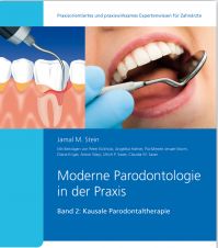 Moderne Parodontologie in der Praxis - Band 2 Kausale Parodontaltherapie Prof. Dr. Stein